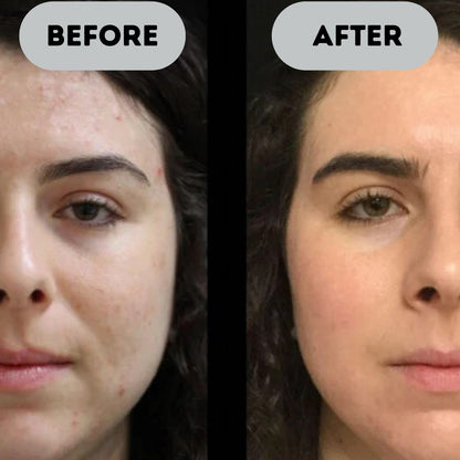 Solvraa™ - Anti-Aging Booster Pro